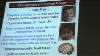 Dr Azza   Protozoa 5   Trypanosoma   Part 4   YouTube