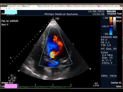 Med View GitHub - jap1968/medview: Medical (DICOM) image viewer in HTML5 ...