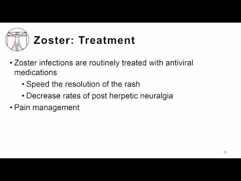 VZV: Diagnosis, Treatment & Prevention