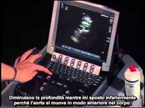Come vivere con il dolore dellarticolazione dellanca Dolore nella parte sinistra delladdome irradia alla schiena