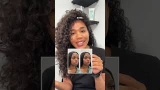 How to avoid Ozempic face! #glp1 #weightloss #hollowundereyes #antiaging #collagen