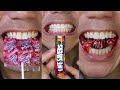 Satisfying ASMR Charms Sweet Pops Life Savers Hacks Candy ASMR DoctorTristanPeh