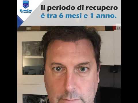 download lagu mp3 mp4 Quando Iniziano A Cadere I Capelli, download lagu Quando Iniziano A Cadere I Capelli gratis, unduh video klip Quando Iniziano A Cadere I Capelli