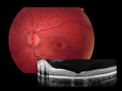 Retina: Imaging & Electrophysiology