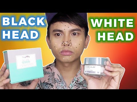 Beauty Geek Betul Ke Di Atas Hidung Itu Blackhead Whitehead Wattpad