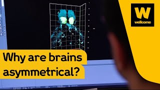 Why the left brain and right brain are so different | Wellcome