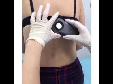 Дерматоскопия – диагностика новообразований на коже