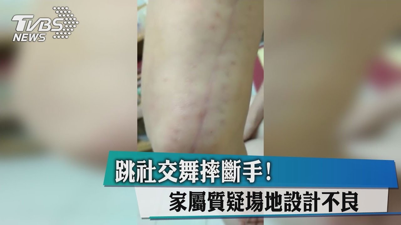 跳社交舞摔斷手！　家屬質疑場地設計不良