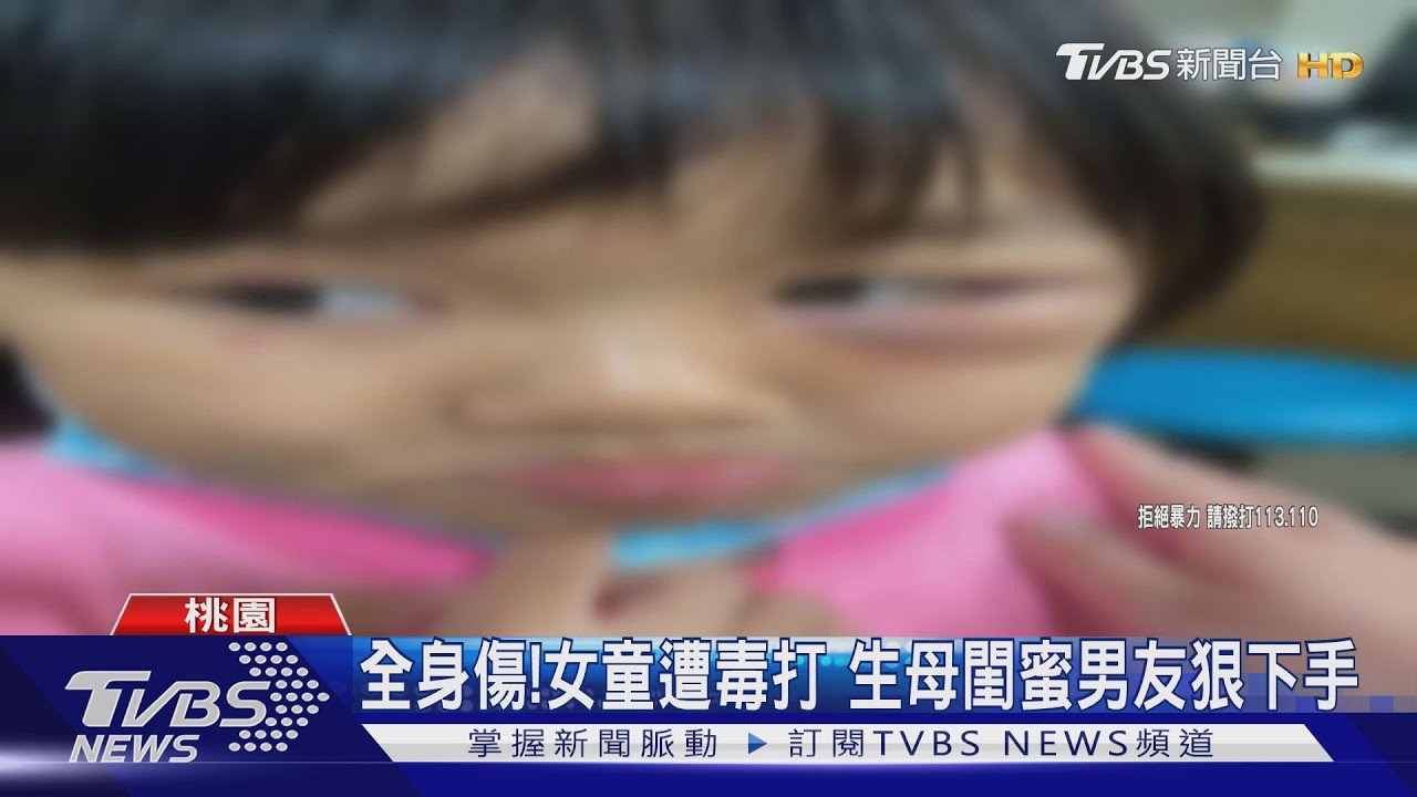 全身傷!女童遭毒打 生母閨蜜男友狠下手