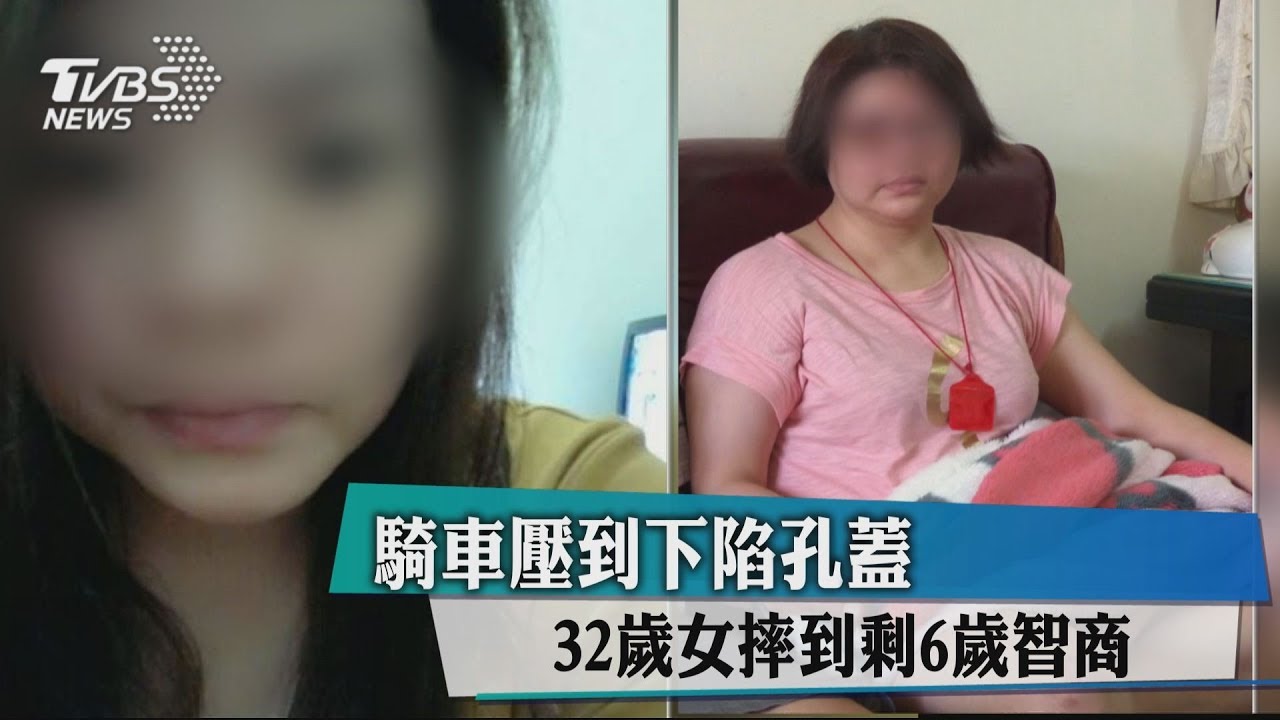 騎車壓到下陷孔蓋 32歲女摔到剩6歲智商