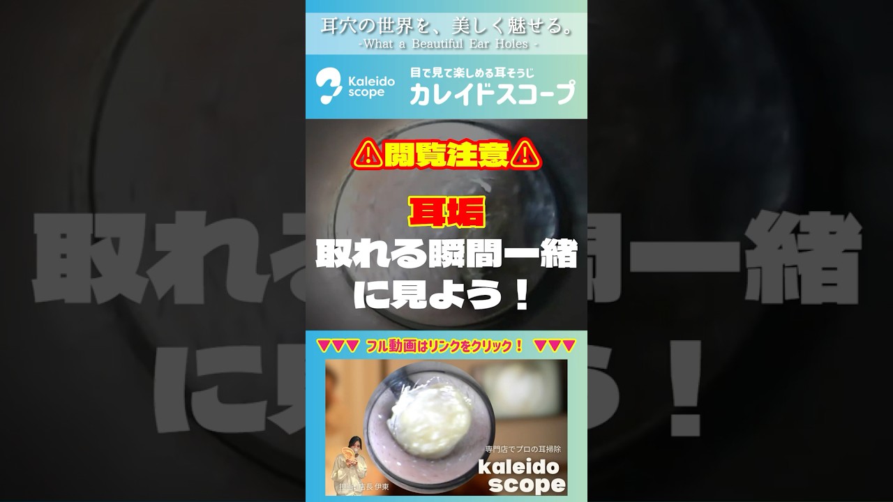 【閲覧注意】耳垢取れる瞬間、一緒に見よう！