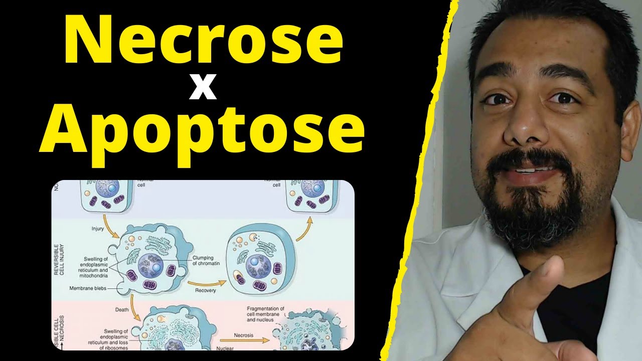 Quais as Diferenças Entre Necrose e Apoptose? | Tipos de Morte Celular | Curso de #Patologia Humana