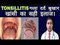 TONSILLITIS गला दर्द बुखार खांसी का सही इलाज Dr 