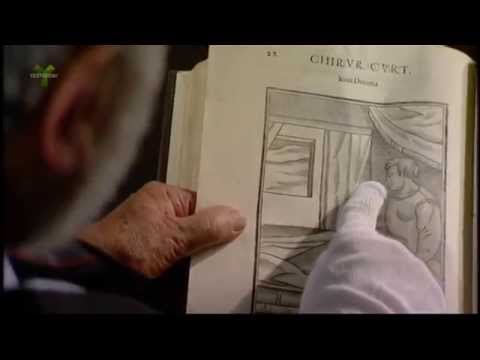 Revolutionary Nasal Reconstruction in 16th Century Italy