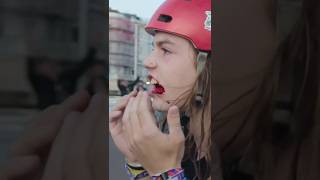 Download lagu WHEN THE BIKE BITES BACK! mp3