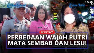 Download lagu Kondisi Wajah Putri Candrawathi Jadi Sorotan Hingga Menangis Sebut Tulus Mencintai Ferdy Sambo! mp3