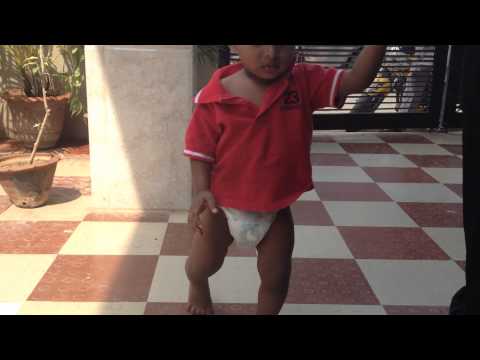 Abnormal Gait In A 20 Month Old Baby, How To Proceed?