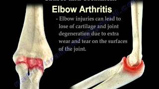 ELBOW PAIN CAUSES AND TREATMENT - Everything You Need To Know - Dr. Nabil Ebraheim