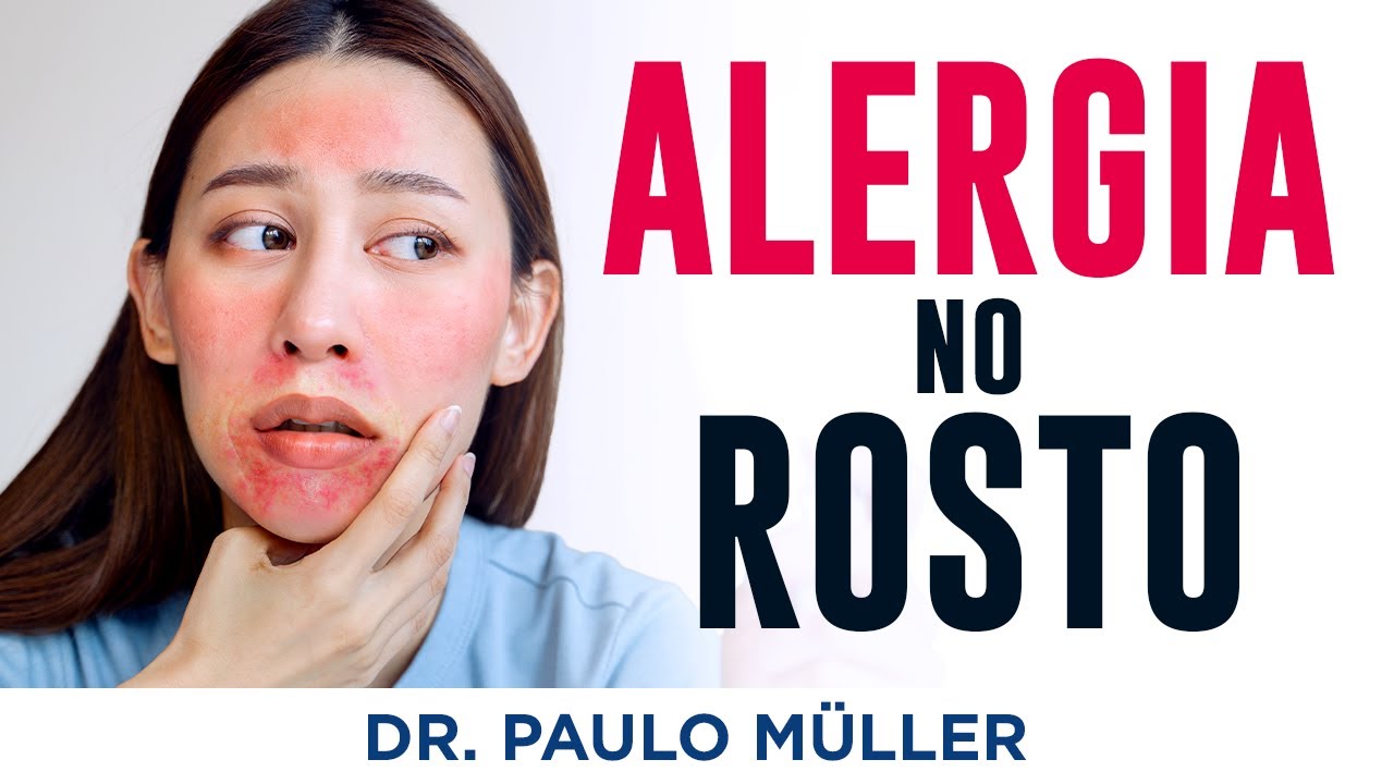 Alergia no Rosto (Dermatite da Face) – Dr. Paulo Müller Dermatologista.