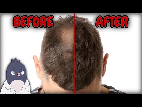 Special Vitamin E Helps Regrow 34% More Hair?