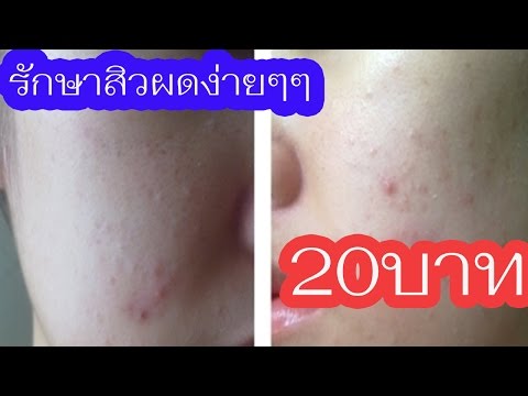 ทำไมบางหน้าอกใหญ่และคนอื่น ๆ ที่มีขนาดเล็ก ขนาดหน้าอกเทียม 5