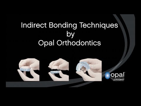 download lagu mp3 mp4 Opal Etch, download lagu Opal Etch gratis, unduh video klip Opal Etch