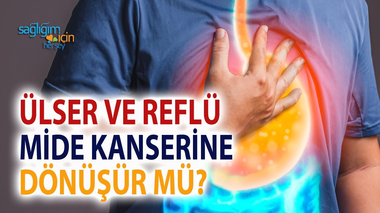 Ülser ve Reflü Mide Kanserine Dönüşür mü?