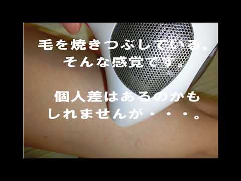 【レビュー】TRIAで髭脱毛を3年間やってみた/Tria laser use before and after