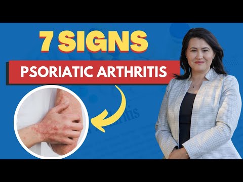 , title : '7 Signs of Psoriatic Arthritis'