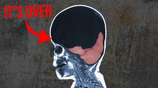 Rabies Situation Is Insane