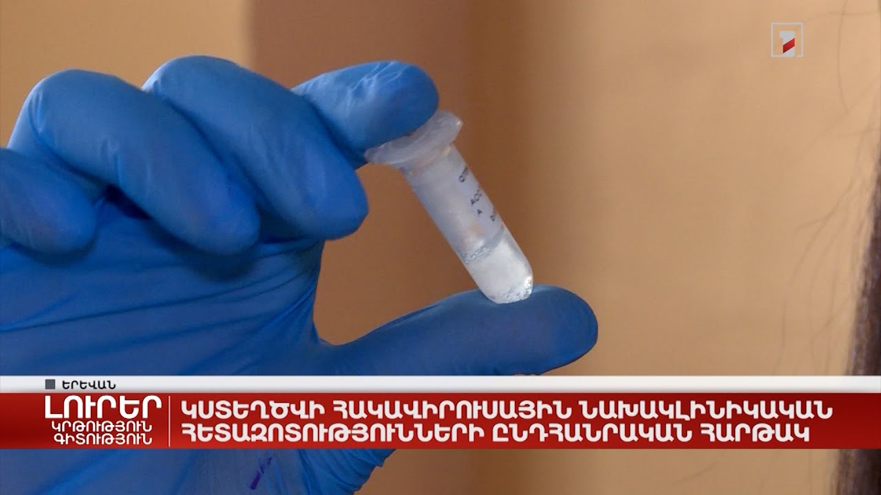 Կստեղծվի հակավիրուսային նախակլինիկական հետազոտությունների ընդհանրական հարթակ