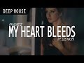 PaulWetz - My Heart Bleeds (ft. Lee Nash) 