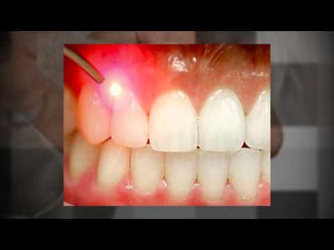 download lagu mp3 mp4 Dentist Ramsgate, download lagu Dentist Ramsgate gratis, unduh video klip Dentist Ramsgate