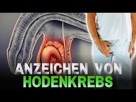 7 Anzeichen von Hodenkrebs, die du nicht ignorieren solltest