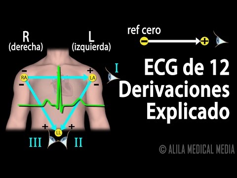 ECG de 12 Derivaciones Explicado, Animación.  Alila Medical Media Español.