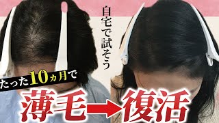【薄毛も改善】正しい知識が薄毛の悩みを改善。自宅で出来る薄毛対策