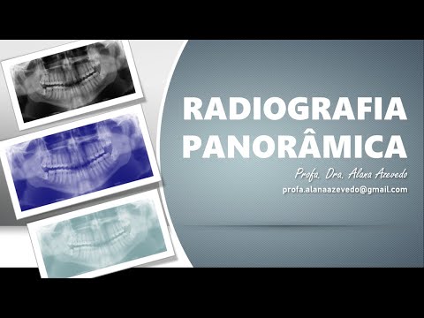 Aula: Radiografia Panorâmica