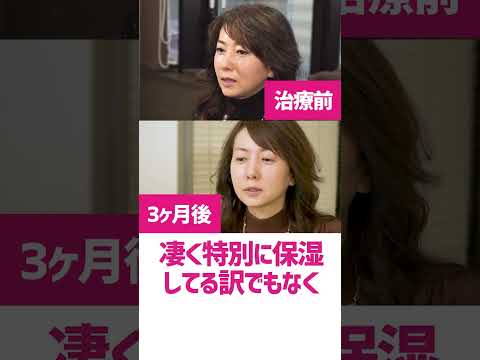 シワは消えましたか?一部のアンチエイジング方法はひどい結果に終わる可能性があります