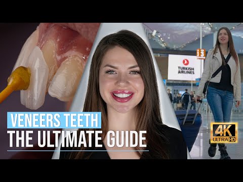 Your Ultimate Guide to Having Veneers teeth in Turkey