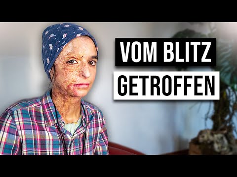 Wie ist das VOM BLITZ GETROFFEN ZU WERDEN?