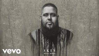 Rag'n'Bone Man - Skin (Bilel Remix) [Audio]