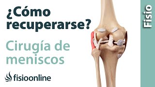 Cómo recuperarse tras una cirugía de menisco.