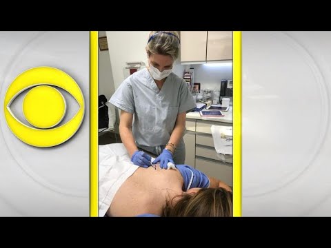 How to minimize your risk of melanoma