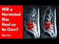 Will A Herniated Disc Heal On Its Own SURPRISING ANSWER