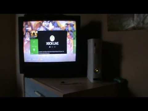comment augmenter stockage xbox 360