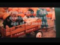 Mother Explains Early Years With Severe Autism