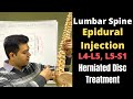 Spinal Injections For Lower Back Pain Epidural Steroid Injection For Sciatica Spine Injection