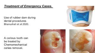 New challenges in dental treatment- Part II