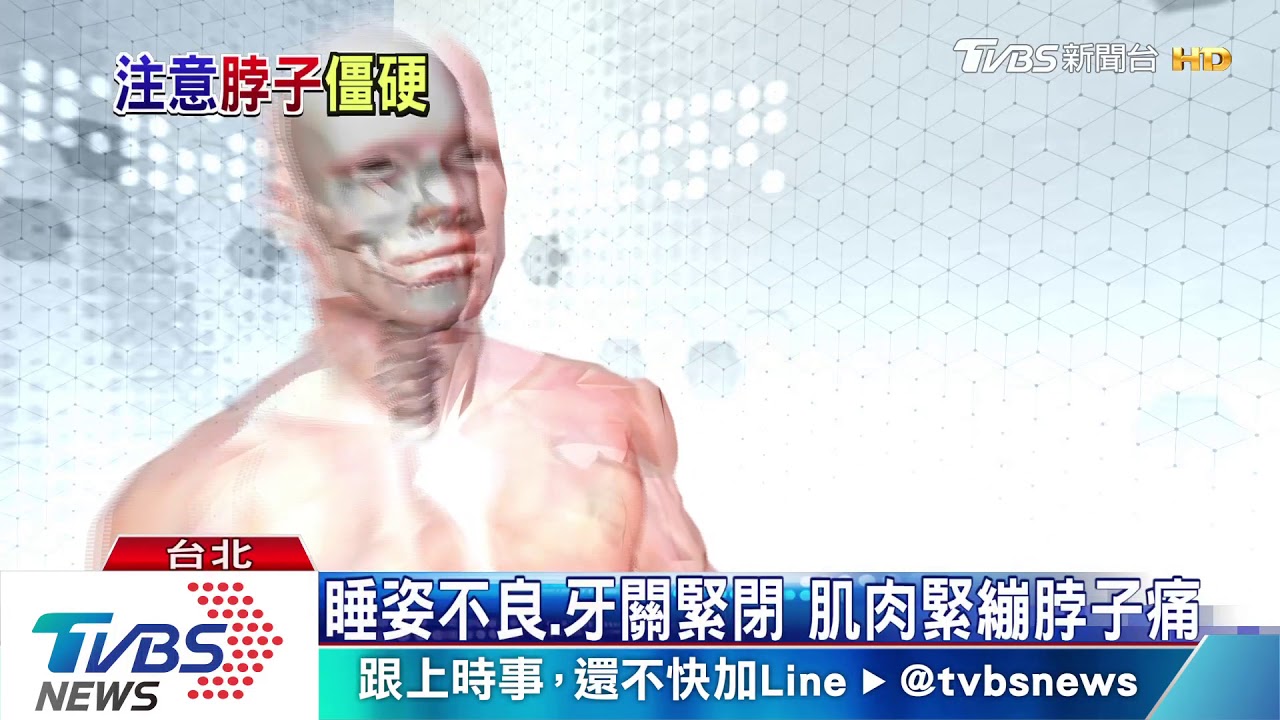 肌肉緊繃、姿勢不良引起脖子疼痛 勿輕忽