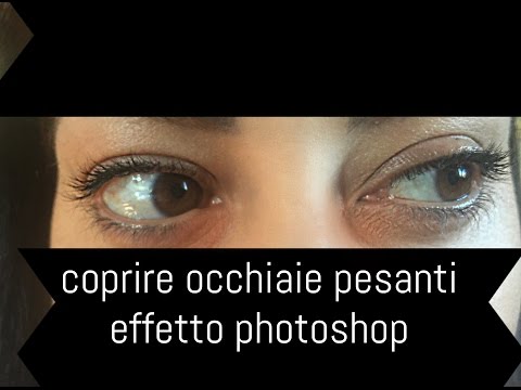 Per mezzo di un limone è possibile liberarsi da lentiggini Abbronzatura senza lentiggini